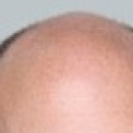 BaldCEO